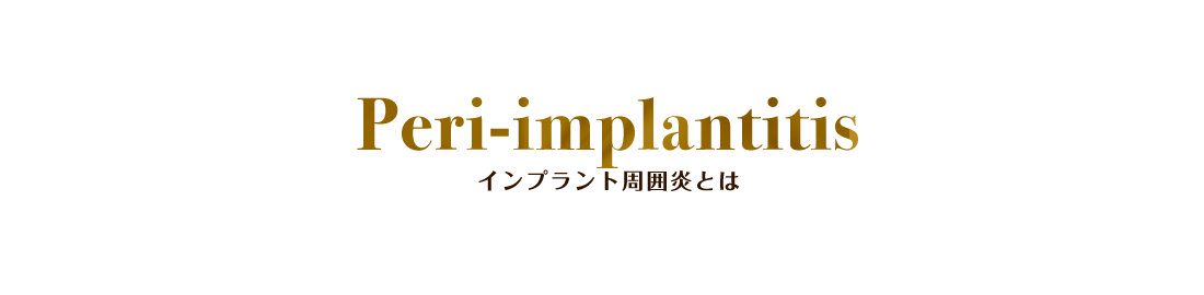 Peri-implantitis インプラント周囲炎とは